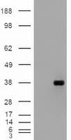 EPCAM Antibody (clone OTI2G1)