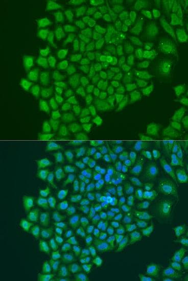 YBX1 / YB1 Antibody