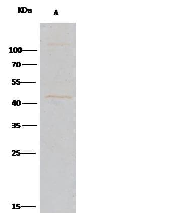 Polyclonal Rabbit anti-Human CPA1 / Carboxypeptidase A Antibody (Preservative Free, IHC, WB)