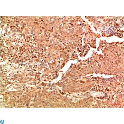 Monoclonal Mouse anti-Human RELA / NFKB p65 Antibody (WB)