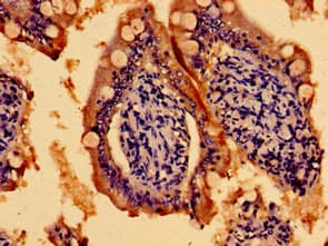 Polyclonal Rabbit anti-Human TMEM67 Antibody