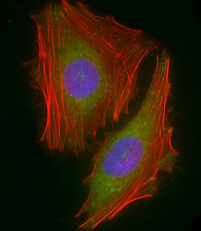 IHC-plus™ Polyclonal Rabbit anti-Human RARRES2 / Chemerin Antibody (N-Terminus, IHC, IF, WB)