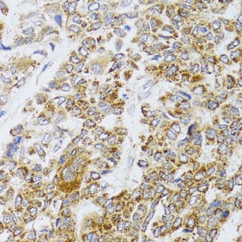 AIFM3 Antibody