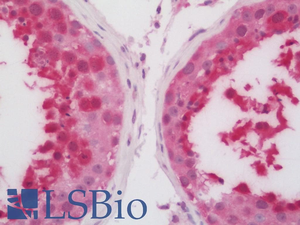 IHC-plus™ HSPA6 / HSP70B' Antibody