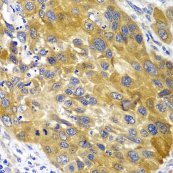 Polyclonal Rabbit anti-Human AK1 / Adenylate Kinase 1 Antibody (IHC, IF, WB)