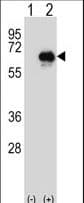 Polyclonal Rabbit anti-Human CETP Antibody (aa34-65, WB)