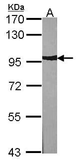 IHC-plus™ ACTN2 Antibody