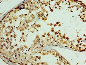 Polyclonal Rabbit anti-Human GPRC5A / RAI3 Antibody (aa258-357, IHC, WB)
