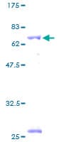 Human BCKDHB Protein (Recombinant GST)