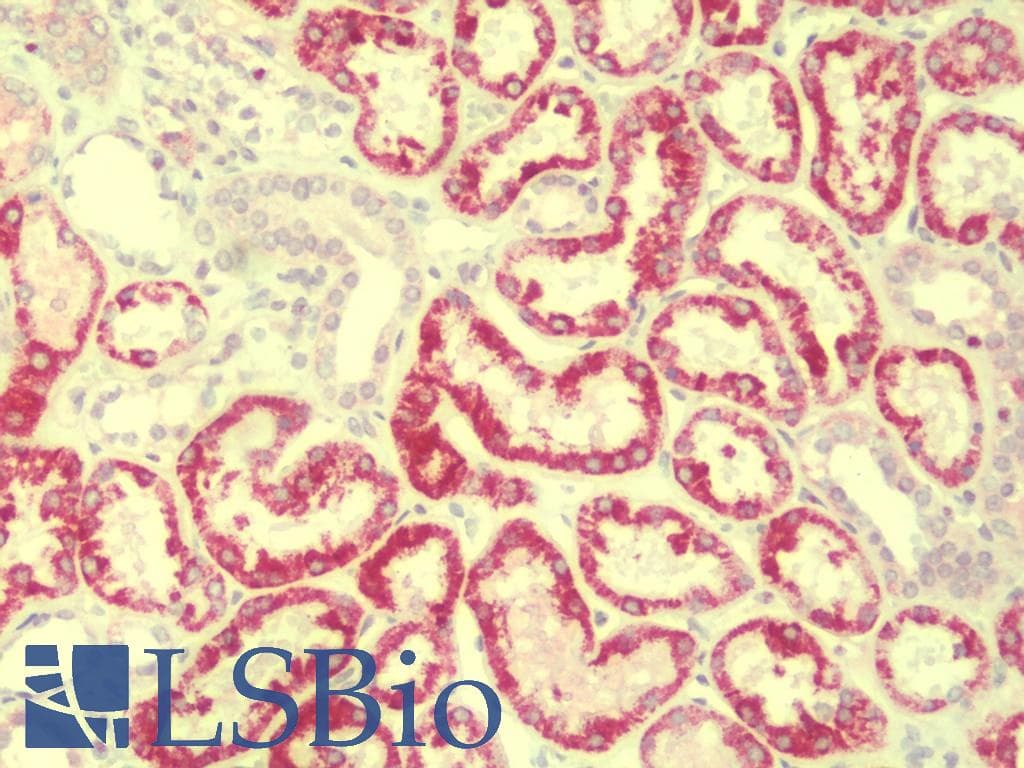 IHC-plus™ Polyclonal Rabbit anti-Human HDGFRP2 Antibody (IHC, IF, WB)