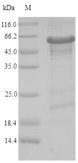 Human ZNF638 Protein (Recombinant 6His-SUMO, N-terminus)