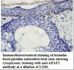Polyclonal Rabbit anti-Human APAF1 / APAF-1 Antibody (N-Terminus, IHC, WB)