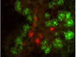 CELA1 / Pancreatic Elastase 1 Antibody (Lyophilized)
