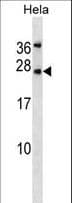 Leptin Antibody (aa8-37)
