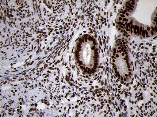 SMC1A / SMC1 Antibody (aa889-1016, clone OTI3G4, Carrier-free)