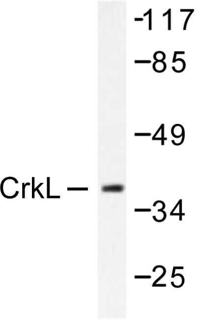 Polyclonal Rabbit anti-Human CRKL Antibody (Pro201, IHC, IF, WB)