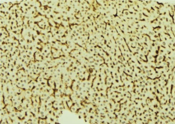 VRK2 Antibody