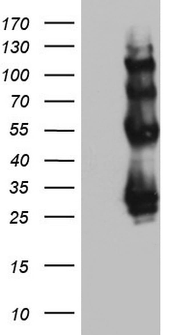 PROCR / EPCR Antibody (aa1-210, clone OTI1H10)