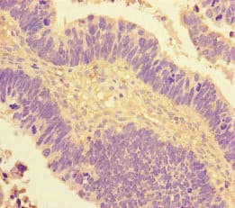 COUP-TFII / NR2F2 Antibody