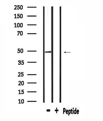 RAD23B / HR23B Antibody