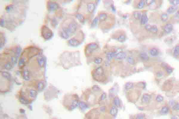 CRKL Antibody (phospho-Tyr207)