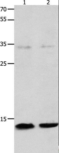 MLC2 / MYL9 Antibody