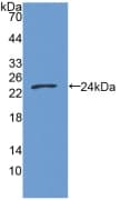 GAS6 Antibody (aa136-311)