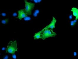 Monoclonal Mouse anti-Human CCM2 / Malcavernin Antibody (clone OTI2F9, IHC, IF, WB)