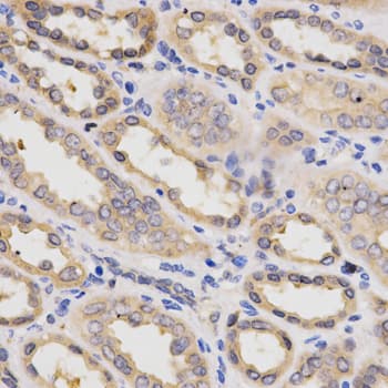 PDPK1 / PDK1 Antibody