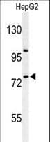 ZNF202 Antibody (aa342-370)