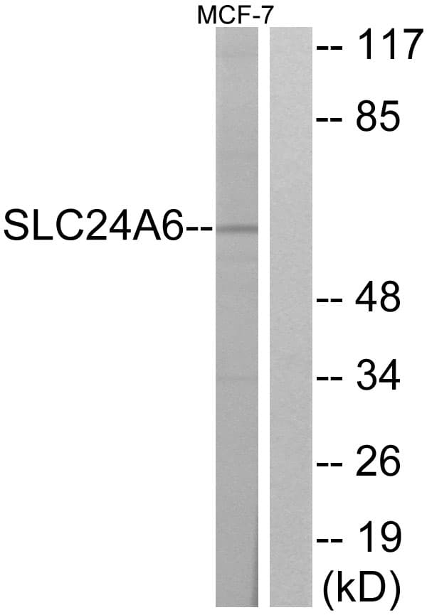 Polyclonal Rabbit anti-Human SLC8B1 / SLC24A6 / NCLX Antibody (aa494-543, WB)