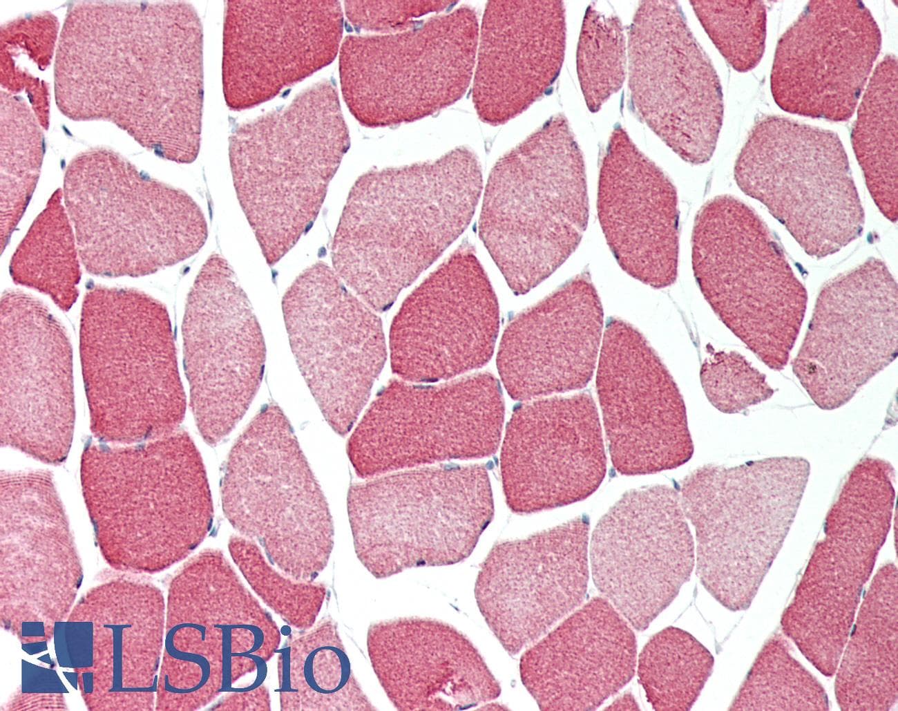 IHC-plus™ MT-ND1 Antibody (Internal)