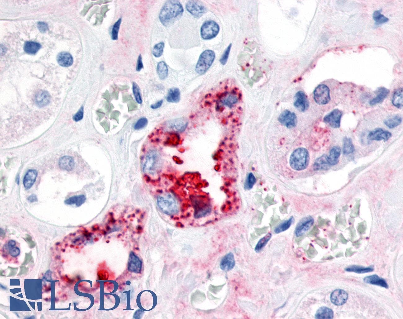 PathPlus™ Polyclonal Rabbit anti-Human ESRRG / ERR Gamma Antibody (N-Terminus, IHC)