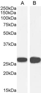 IHC-plus™ Polyclonal Goat anti-Human SFN / Stratifin / 14-3-3 Sigma Antibody (aa204-217, IHC, WB)