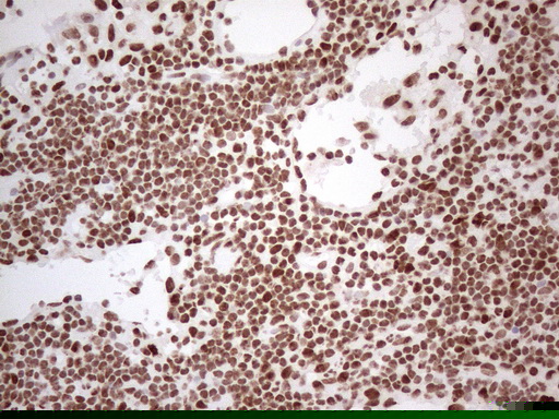 HNRNPL / hnRNP L Antibody (aa270-502, clone OTI4E5, Carrier-free)