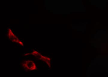 COL5A1 / Collagen V Alpha 1 Antibody