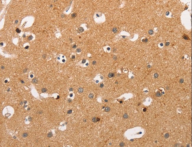 HSPB8 / H11 / HSP22 Antibody