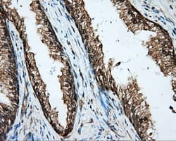 Basigin / Emmprin / CD147 Antibody (clone OTI3E9)