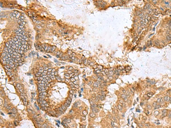 CCDC134 Antibody