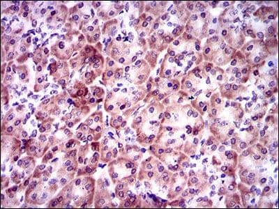 Monoclonal Mouse anti-Human PSAP / Prosaposin Antibody (clone 4D5F4, Amino Acid: 325-524, IHC, IF, WB)
