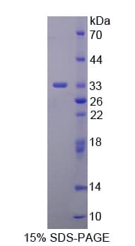 Human WNK1 Protein (Recombinant His-T7)
