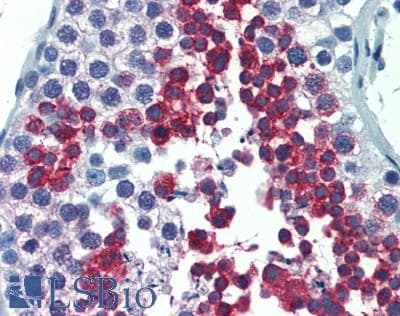 IHC-plus™ Polyclonal Rabbit anti-Human AHI1 Antibody (aa1146-1196, IHC, WB)