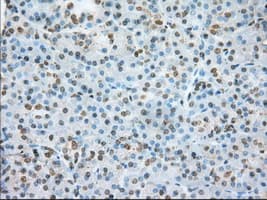 ERCC1 Antibody (clone OTI1B3)