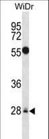 MED6 Antibody (aa135-164)