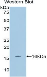 EPO / Erythropoietin Antibody (aa82-192, PE)