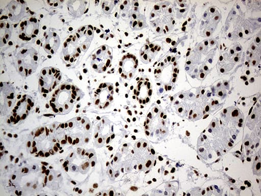 HNRNPH1 / hnRNP H Antibody (clone OTI4F10)