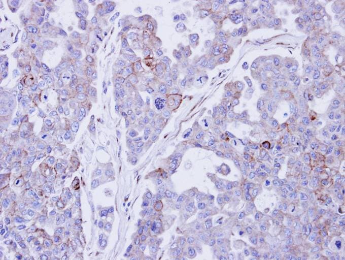 Polyclonal Rabbit anti-Human DSC2 / Desmocollin 2 Antibody (aa480-706, IHC, WB)