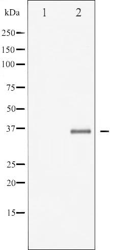 EFNB2 / Ephrin B2 Antibody (phospho-Tyr330)