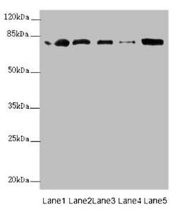 ZBTB48 / HKR3 Antibody