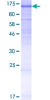 Human ANO6 Protein (Recombinant GST)